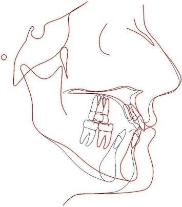 predictivo orto-cirúrgico
